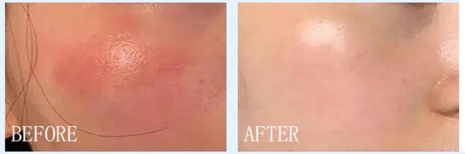 After-Sun Repair Liquid